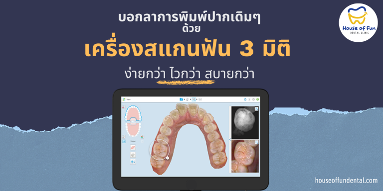 บอกลาการพิมพ์ปากแบบเดิมด้วยเครื่องสแกนฟัน 3 มิติ