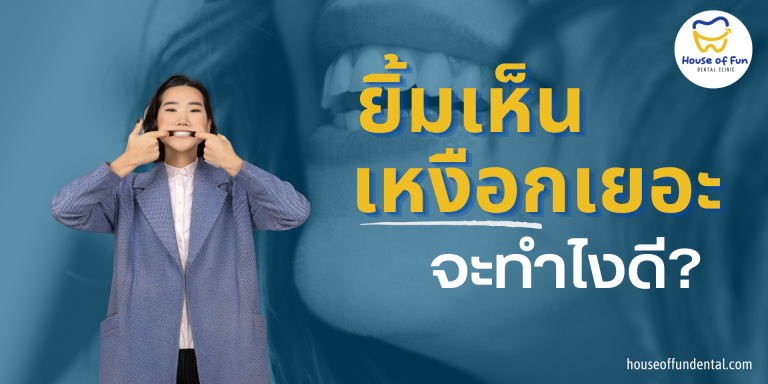 ยิ้มเห็นเหงือกเยอะจะทำยังไงดี