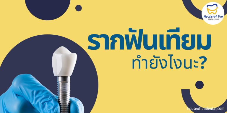 รากฟันเทียม มีขั้นตอนยังไงบ้างนะ