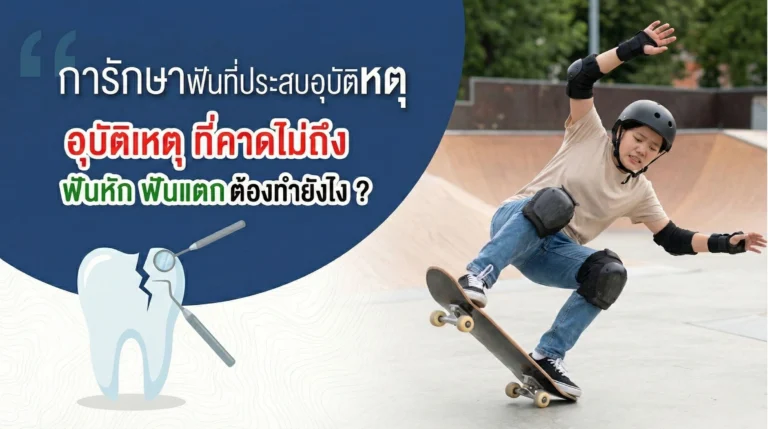 การรักษาฟันหัก ฟันแตก ที่เกิดจากอุบัติเหตุ